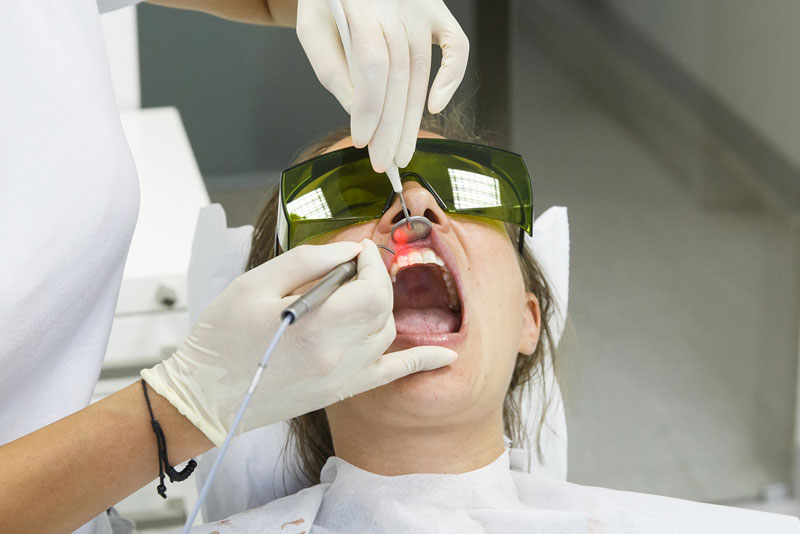 Laser Gum Surgery, Baton Rouge, LA